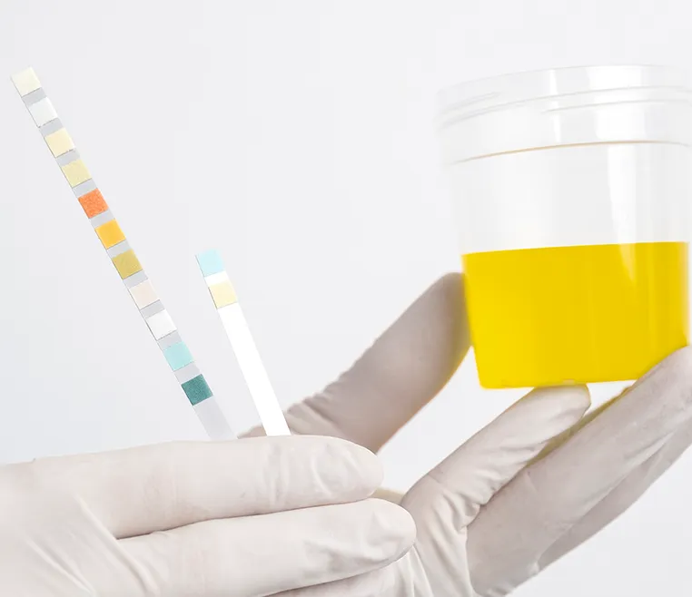 what is uric acid