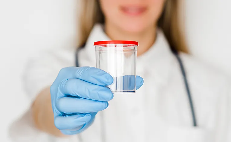 Spermiogram testi (sperm testi)