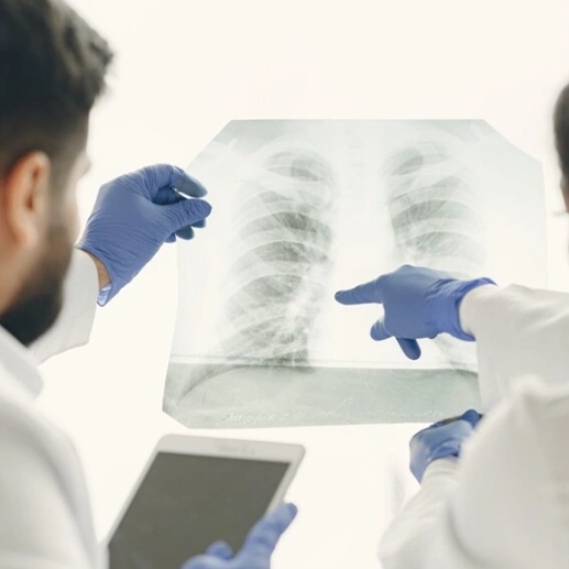 Kistik Fibrozis Tarama Testi