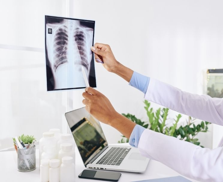 Akciğer Grafisi Yorumlama