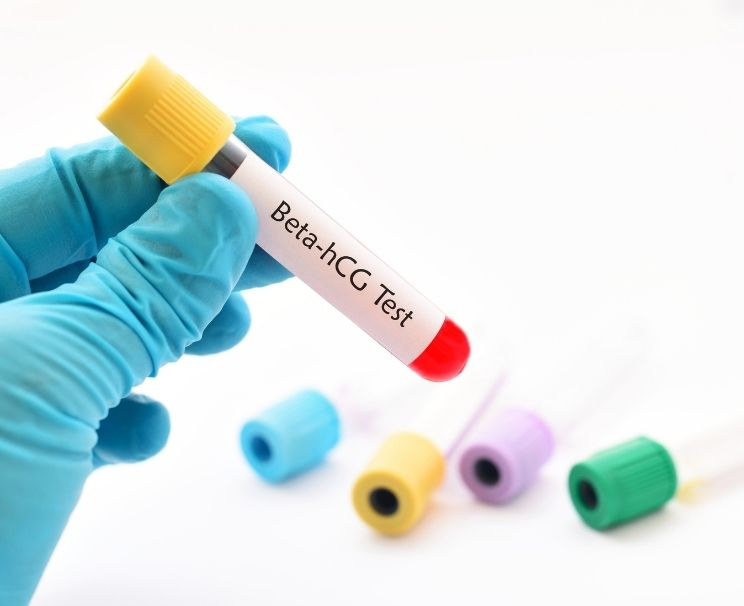 Beta Hcg