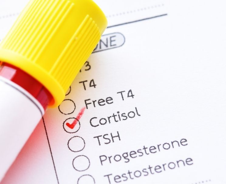 Kortizol Hormonu Nasıl Düşürülür?