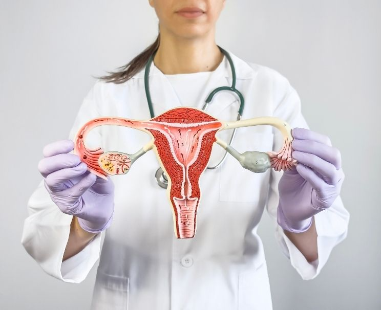 Polycystic Ovary Syndrome Treatment