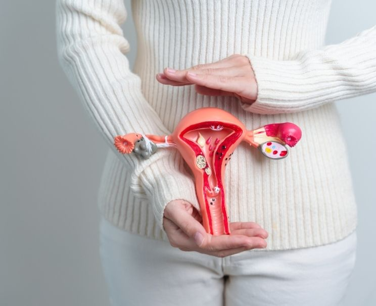 Polycystic Ovary Syndrome Treatment